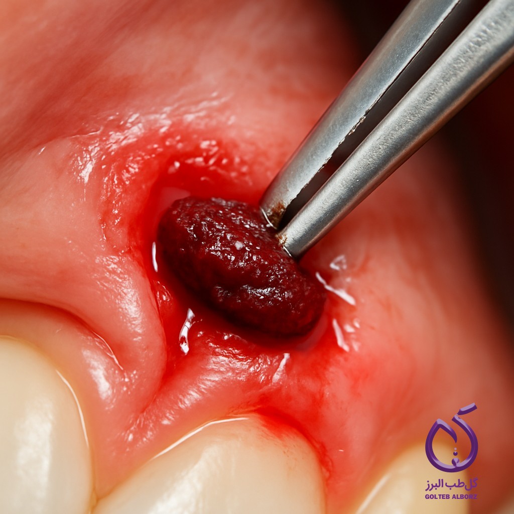 هر آنچه باید درباره هموستات‌های دندانپزشکی بدانید (2025)